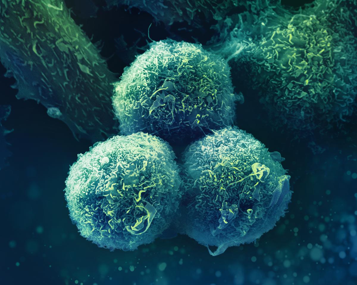 Three cells
